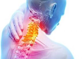 Mina eta aterpetxeak Cervical Zone-en osteokondrosia hirugarren mailarekin